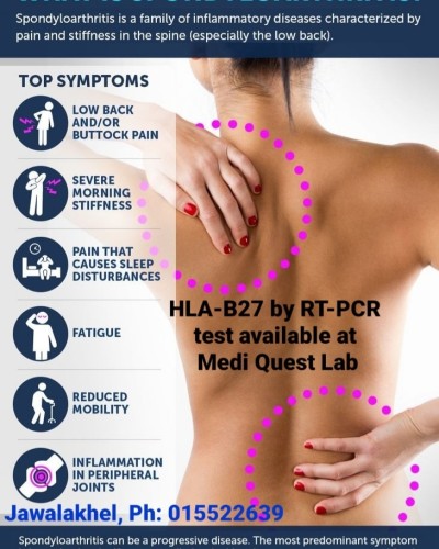 Spondyloarthritis Test Available